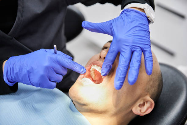 Best Same-Day Emergency Dental Services in Mcleansville, NC