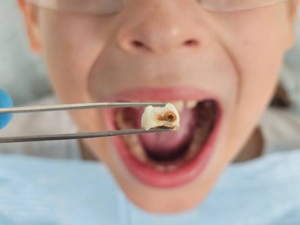 Best Emergency Dental Care for Broken or Chipped Teeth in Mcleansville, NC